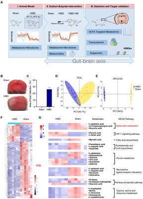 Sodium butyrate mediates histone crotonylation and alleviated neonatal rats hypoxic–ischemic brain injury through gut–brain axis